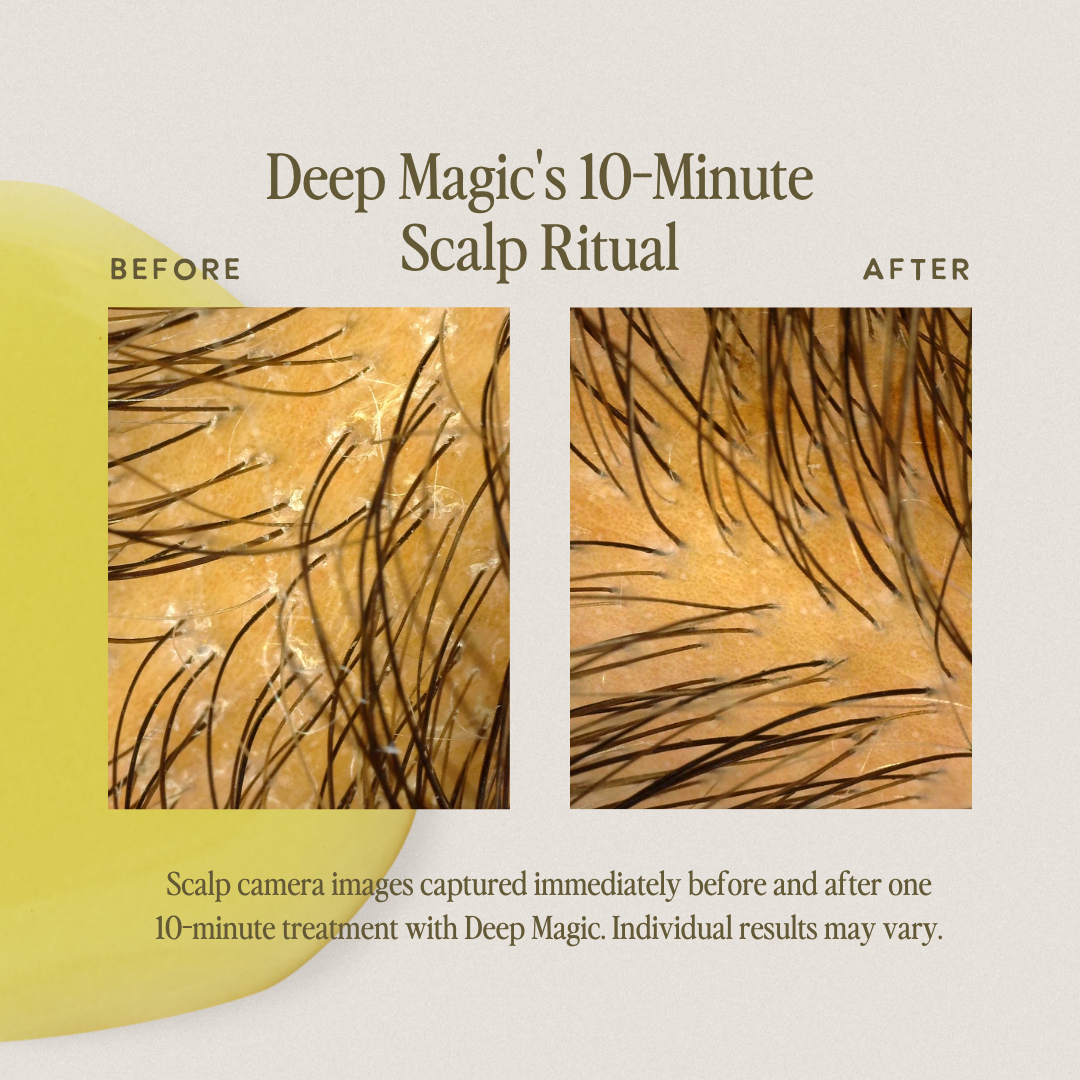 Deep Magic Hair + Scalp Serum - Multi-Use - 2 fl oz